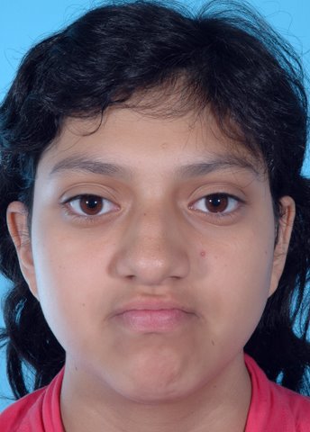 Alexandra before